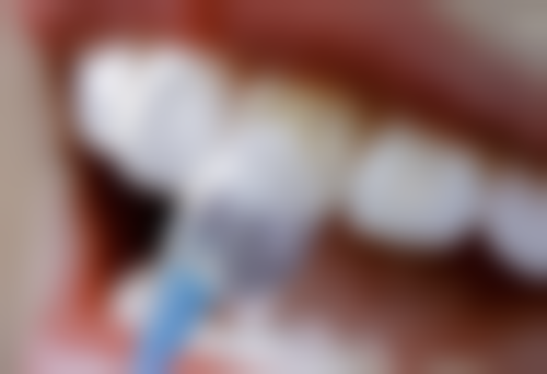 【吴忠时光口腔门诊部诊疗设备：】