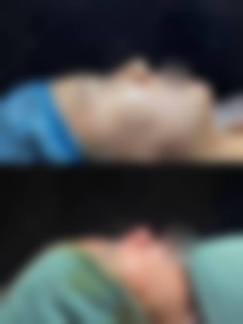 烟台伯仕医疗美容邹元医生手术进行时