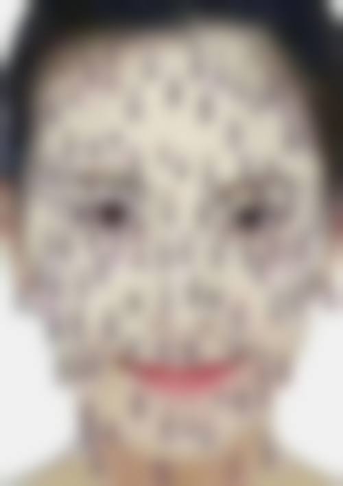 大连爱德丽格医美开展二氧化碳激光点痣项目的优势