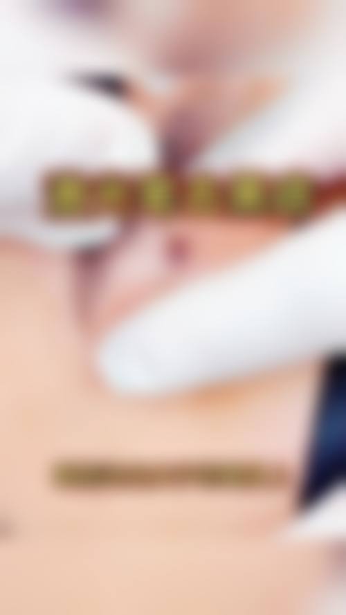 大连爱德丽格医美二氧化碳激光点痣项目的技术优势