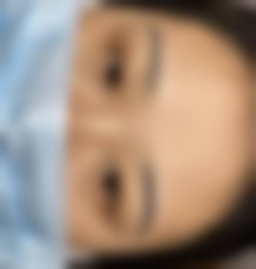 大连爱德丽格医美雾眉/线眉半恒久纹眉项目的口碑