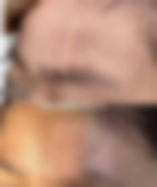 【河南宏力医院烧伤整形科怎么预约挂号?】