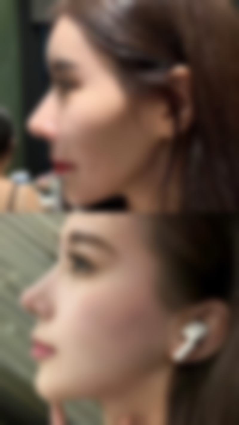 【绵阳久圣美医疗美容诊所特色项目：】