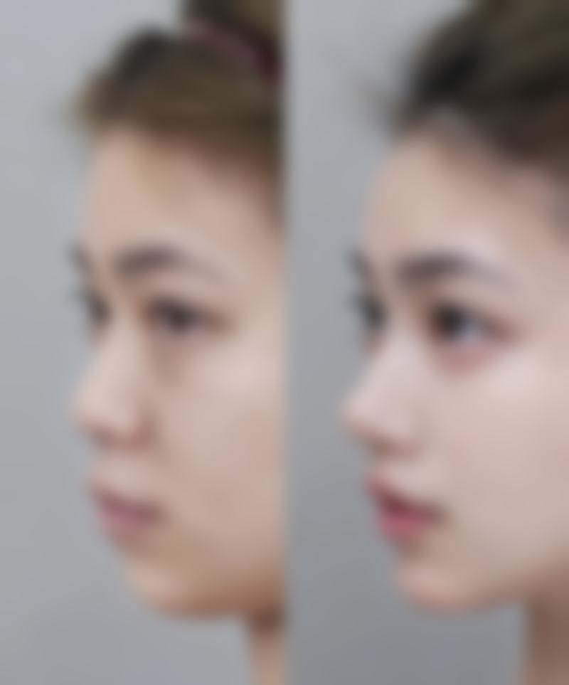 【成都锦城整形美容诊所是正规的吗?】