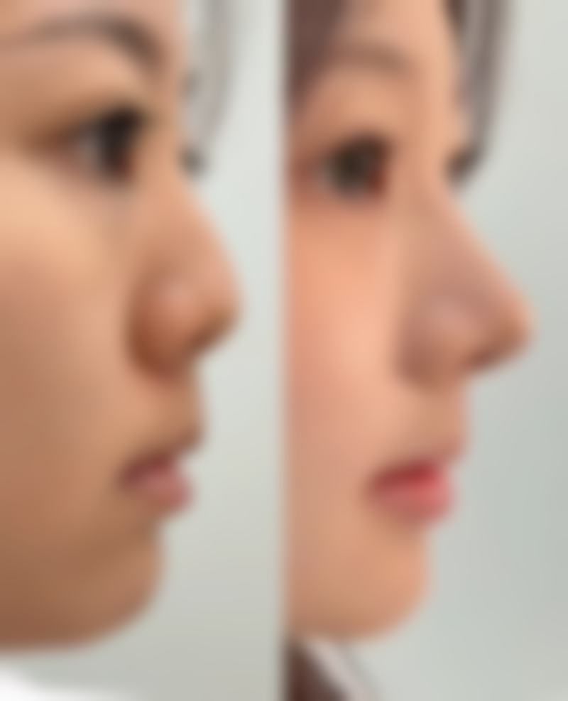 【合肥博士整形美容医院诊疗设备：】