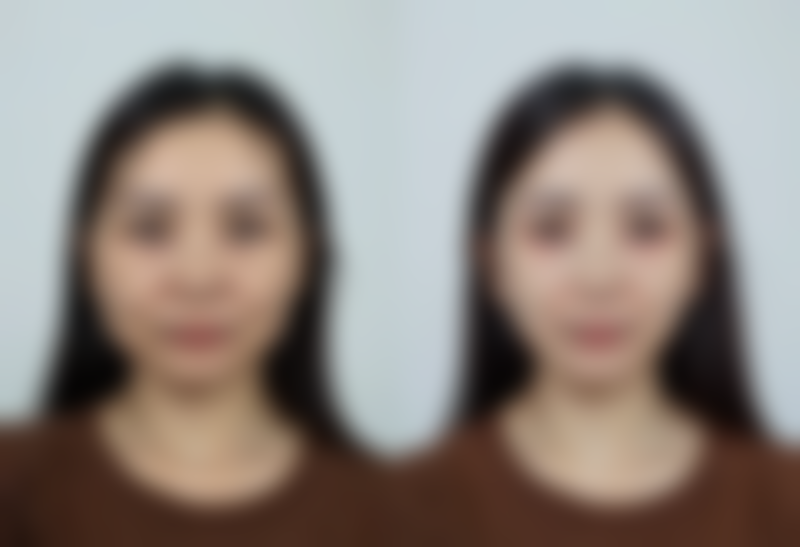 以下是部分项目的参考价格表（价格仅供参考，实际以到院面诊为准）：
|项目|价格区间（元起）|
| ---- | ---- |
|精细化雕刻隆鼻|5000|
|无痕祛眼袋|3000|
|唇部整形|4000|
|纹眉|1000|