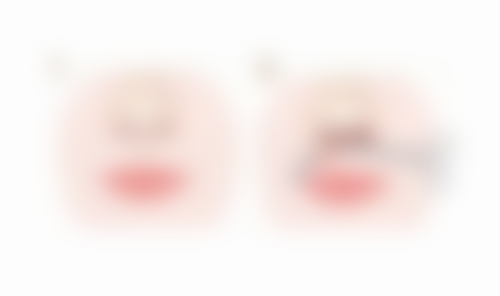 多久打第二针瘦脸针？了解最佳间隔时间，助你轻松拥有持久精致小脸效果！ 