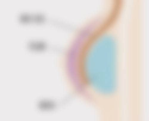 七、做阴道紧缩术多久不能同房