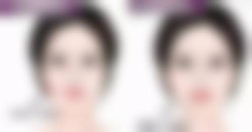 瘦脸针打一次维持多久