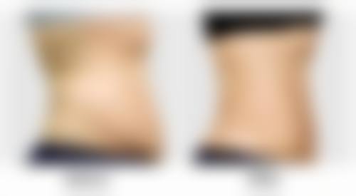 二、做阴道紧缩手术多久可以同房