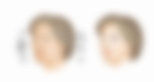 瘦脸针打一次维持多久