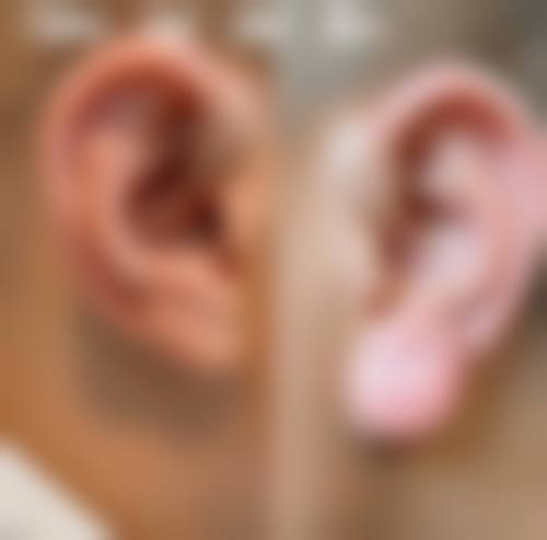 【吉林美辰整形美容医院怎么预约挂号?】