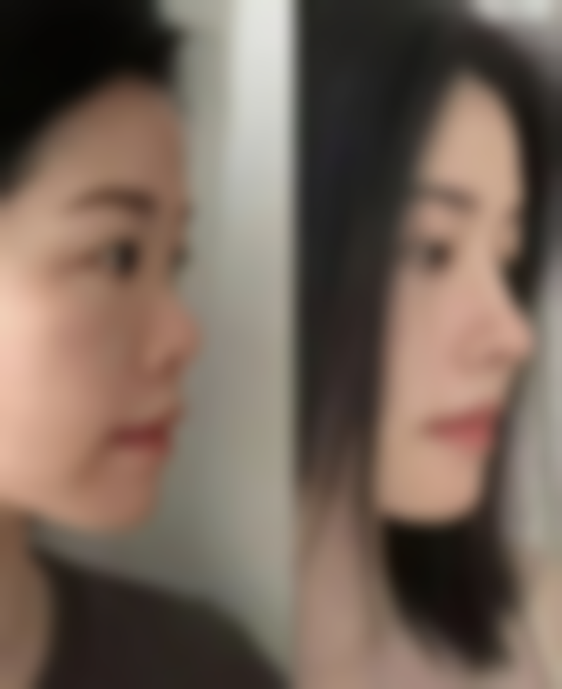 环切包皮手术相关价格情况