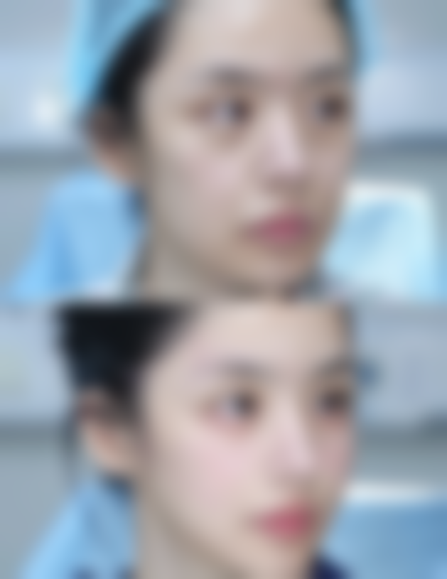 【南京水光工坊整形医院患者口碑评价：】