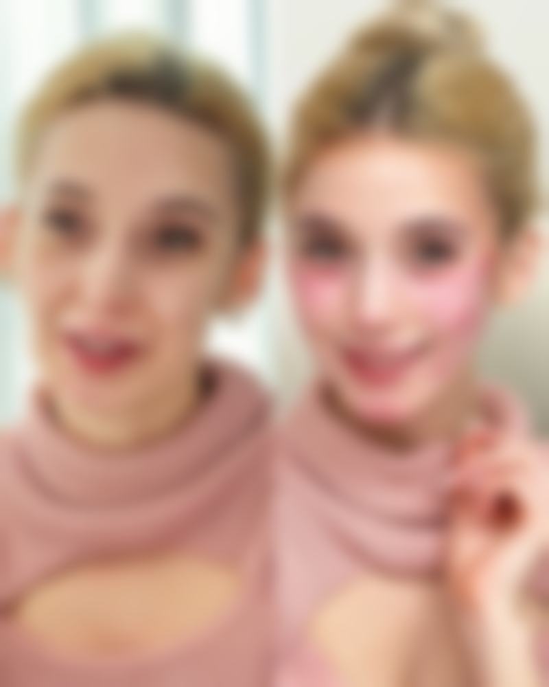 瘦脸针哪里打比较正规