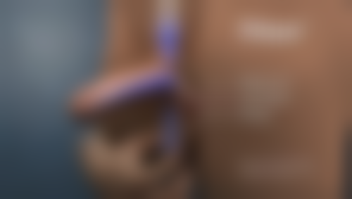 七、阴道紧缩针能维持多久