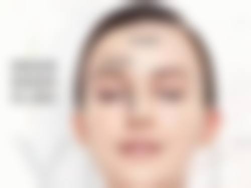 种植的头发还会脱落吗