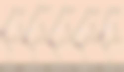 用玻尿酸除皱怎么样？揭秘3大显著效果，90%用户反馈满意度高，让肌肤重焕年轻光彩！ 