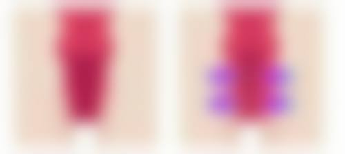 怎么让嘴唇变薄