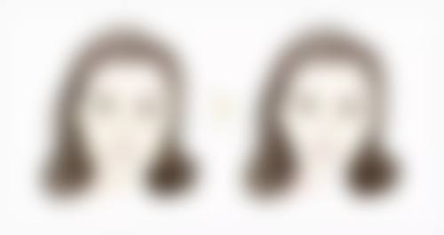 瘦脸针成效维持时间的常见疑问解答