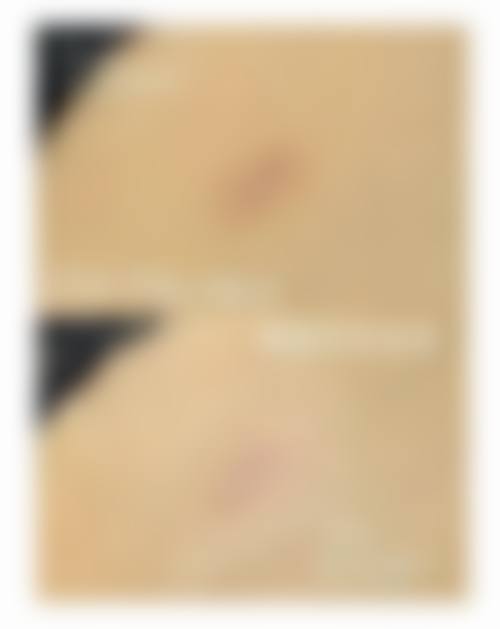 【杭州依妮德融美医疗美容诊所参考价格表：】