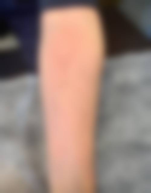 【杨海平医生擅长项目:】