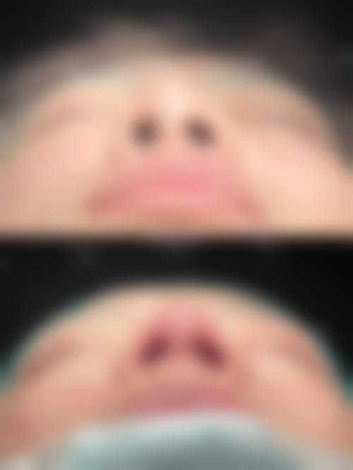 【杨海平医生技术特点:】