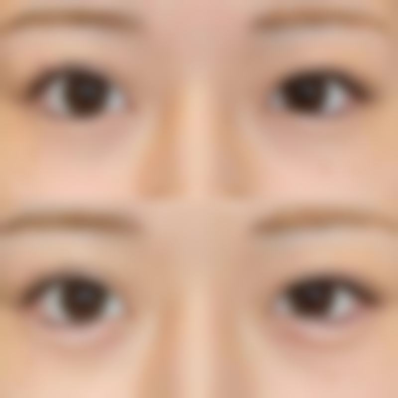 【杨海平医生技术特点:】