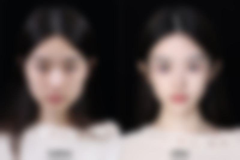 怎么让嘴唇变小变薄图片