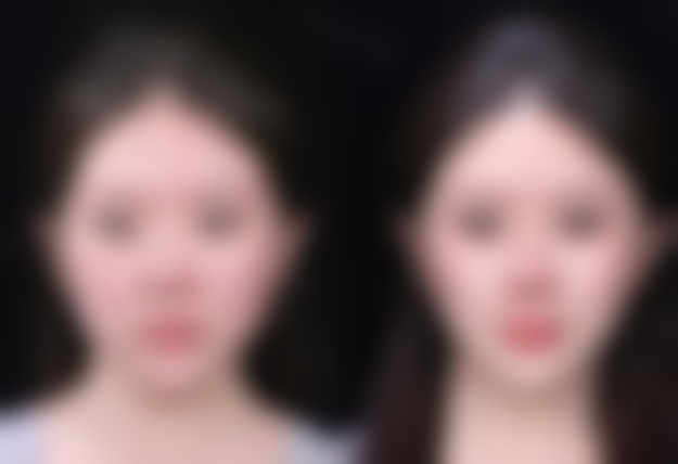 【杨海平医生怎么预约挂号？】