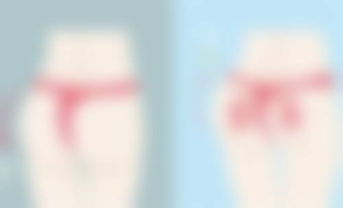 打完瘦脸针多久可以平躺