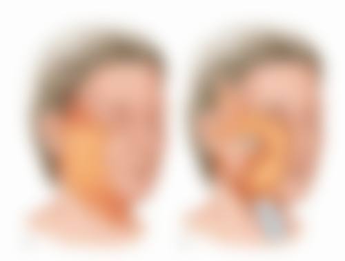 那里打瘦脸针比较好？权威医美机构推荐，三甲医院、知名连锁优势揭秘，助你安全变美！ 