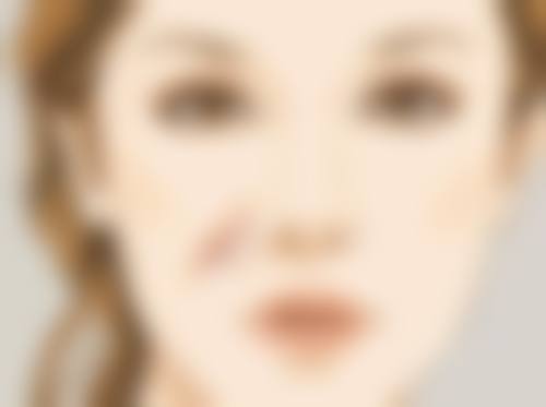 嘴唇怎么整形好看女生