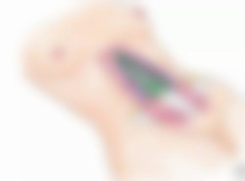 除皱针后多久成效更好