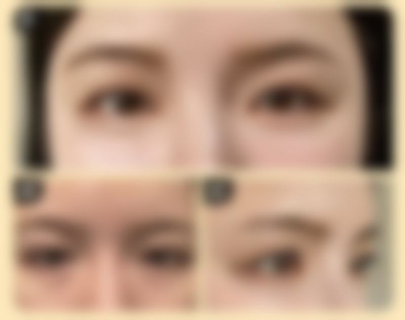 打了瘦脸针三个月怀孕了孩子能要吗