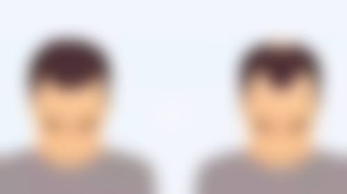 饮食与护理建议