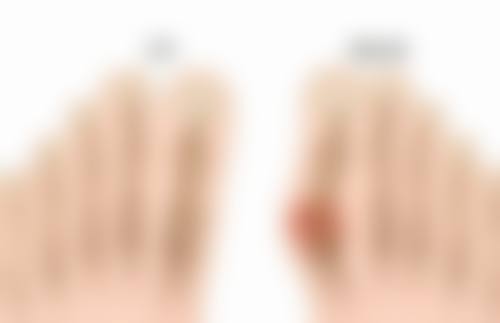 整容唇部有没有风险？权威解析3大常见风险及5种有效规避方法，让你安全拥有迷人唇形！ 