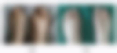 嘴唇整容一般多久恢复？了解3大恢复阶段与5个加速秘诀，助你快速拥有迷人美唇！ 