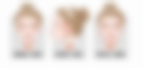 整容嘴唇有什么后遗症