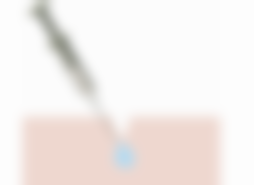 嘴唇整容有什么后遗症吗