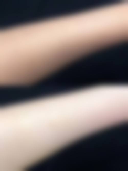 【徐泽华医生擅长项目：】