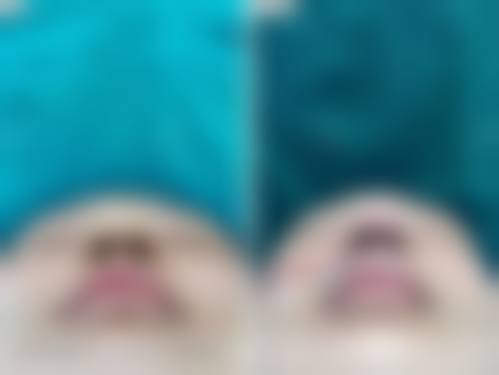 【涂家金医生技术特点:】