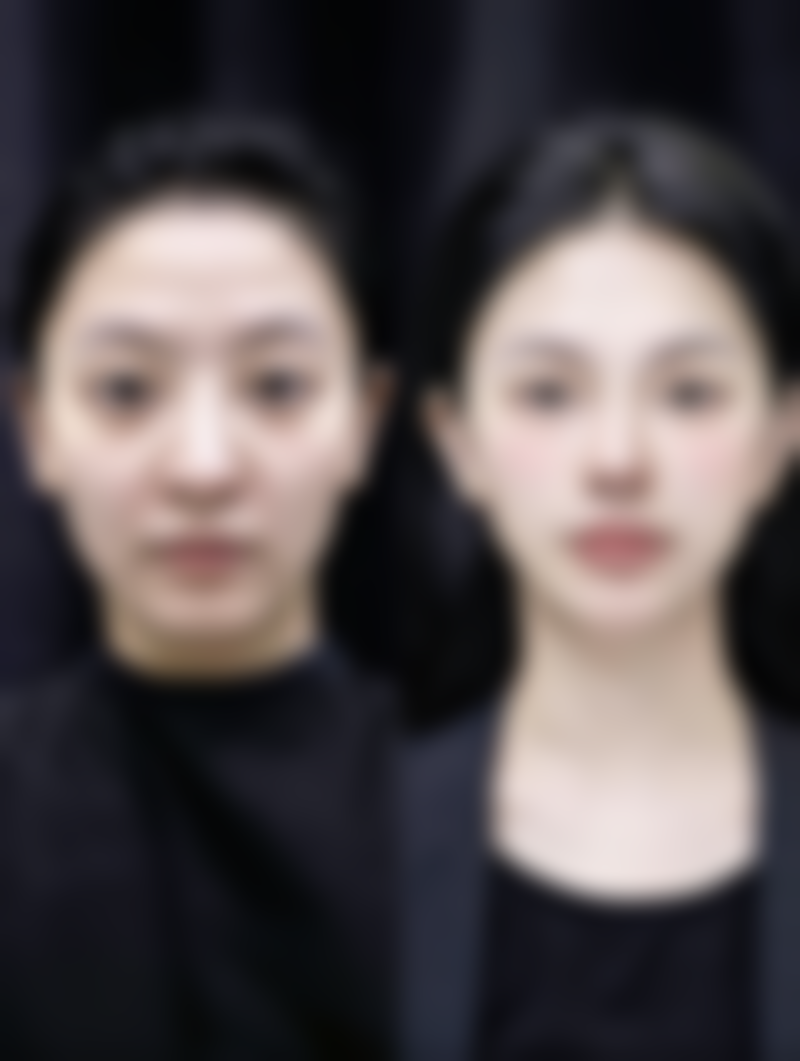 春季适合种植草莓吗北方