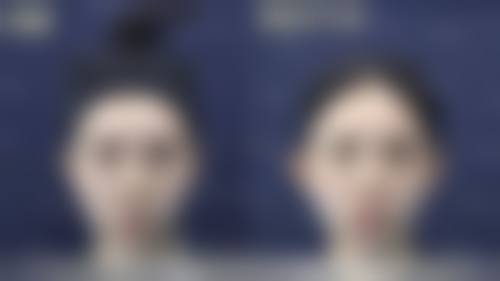 【沈阳唯美付强整形医院参考价格表:】