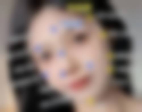 下颚手术风险大吗