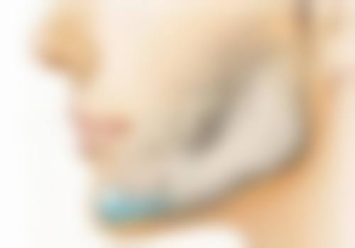 非手术替代方案