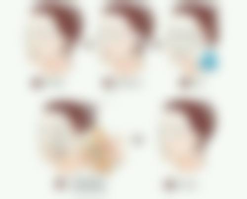 做阴道紧缩术有没有后遗症