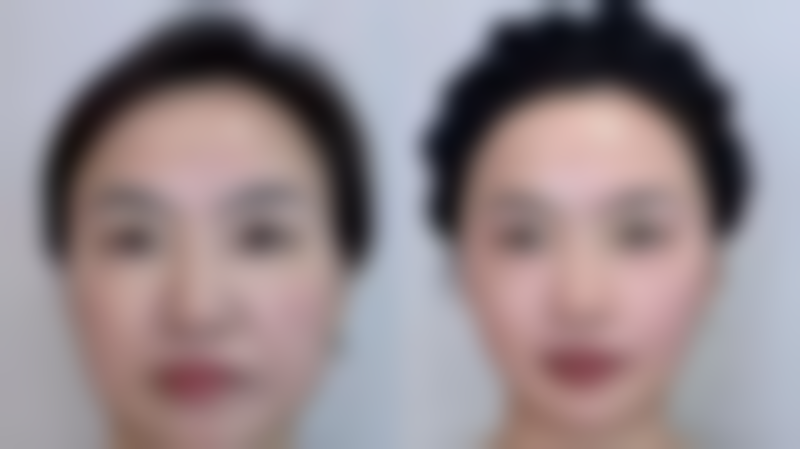 【云南昆明王的整形医院地址:】