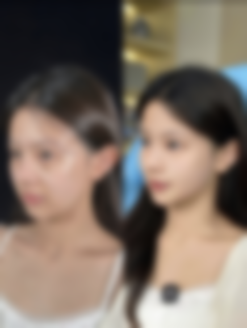 瘦脸针打完多久见效