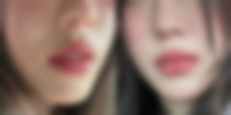 【上海百达丽医疗美容医院参考价格表:】